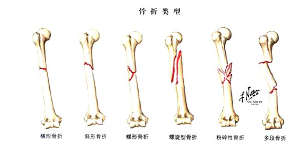 蚂蚁庄园“寒潮橙色预警是什么等级